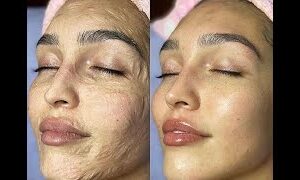 Esthemax Contouring Face Mask