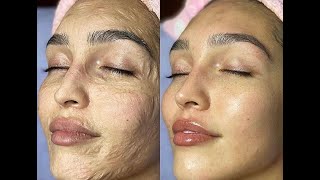 Esthemax Contouring Face Mask